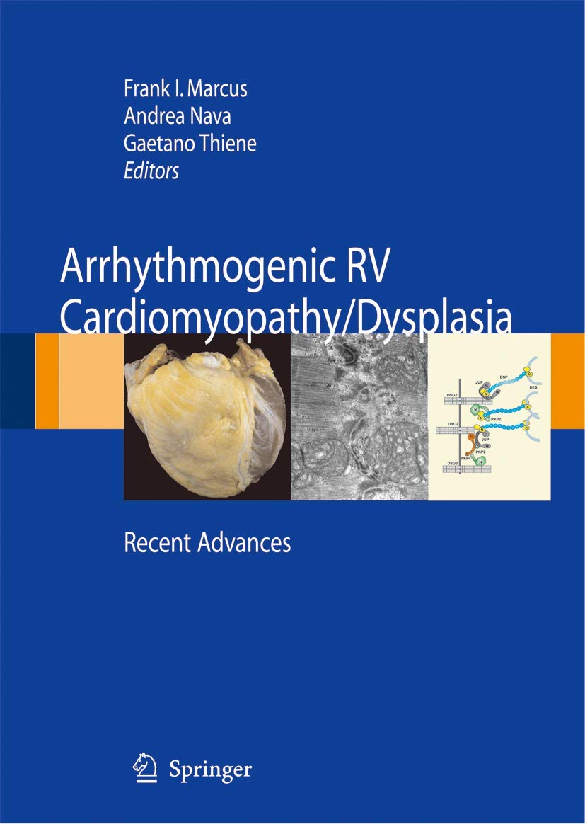 Arrhythmogenic RV Cardiomyopathy/Dysplasia: Recent Advances