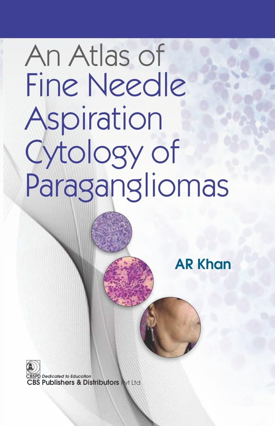 An Atlas of Fine Needle Aspiration Cytology of Paragangliomas
