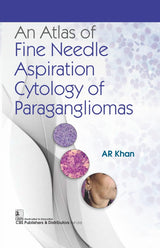 An Atlas of Fine Needle Aspiration Cytology of Paragangliomas