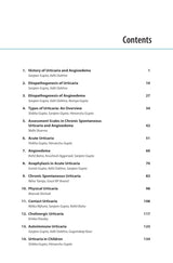 COMPREHENSIVE GUIDE TO URTICARIA