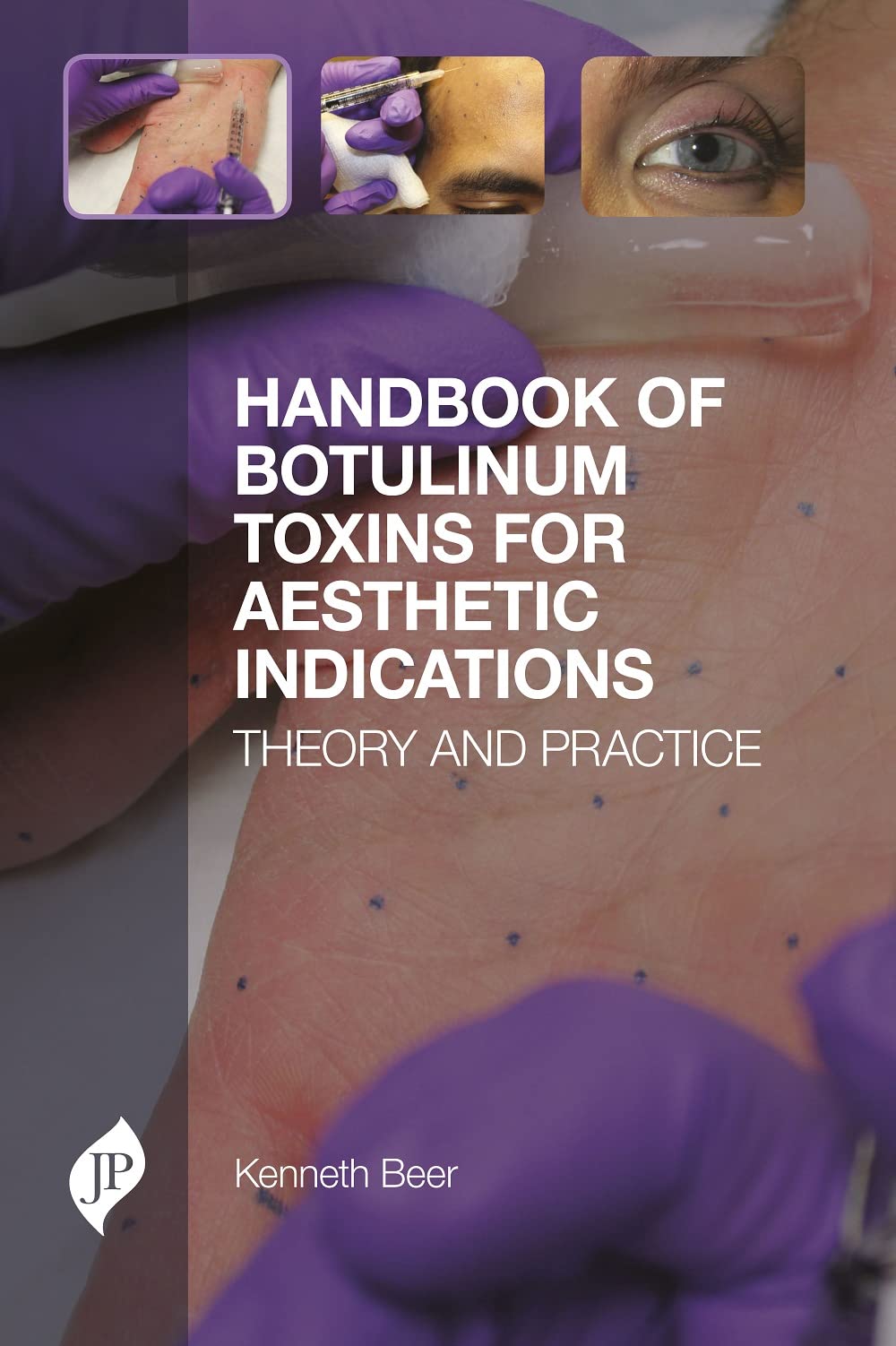 HANDBOOK OF BOTULINUM TOXINS FOR AESTHETIC INDICATIONS THEORY AND PRACTICE
