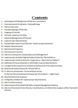 Uterine Leiomyoma 1st Ed. 2019