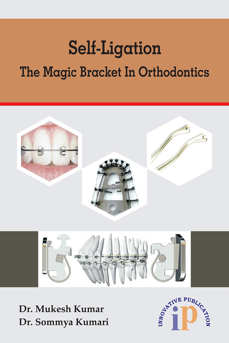 Self-Ligation - The Magic Bracket In Orthodontics - Retail Maharaj