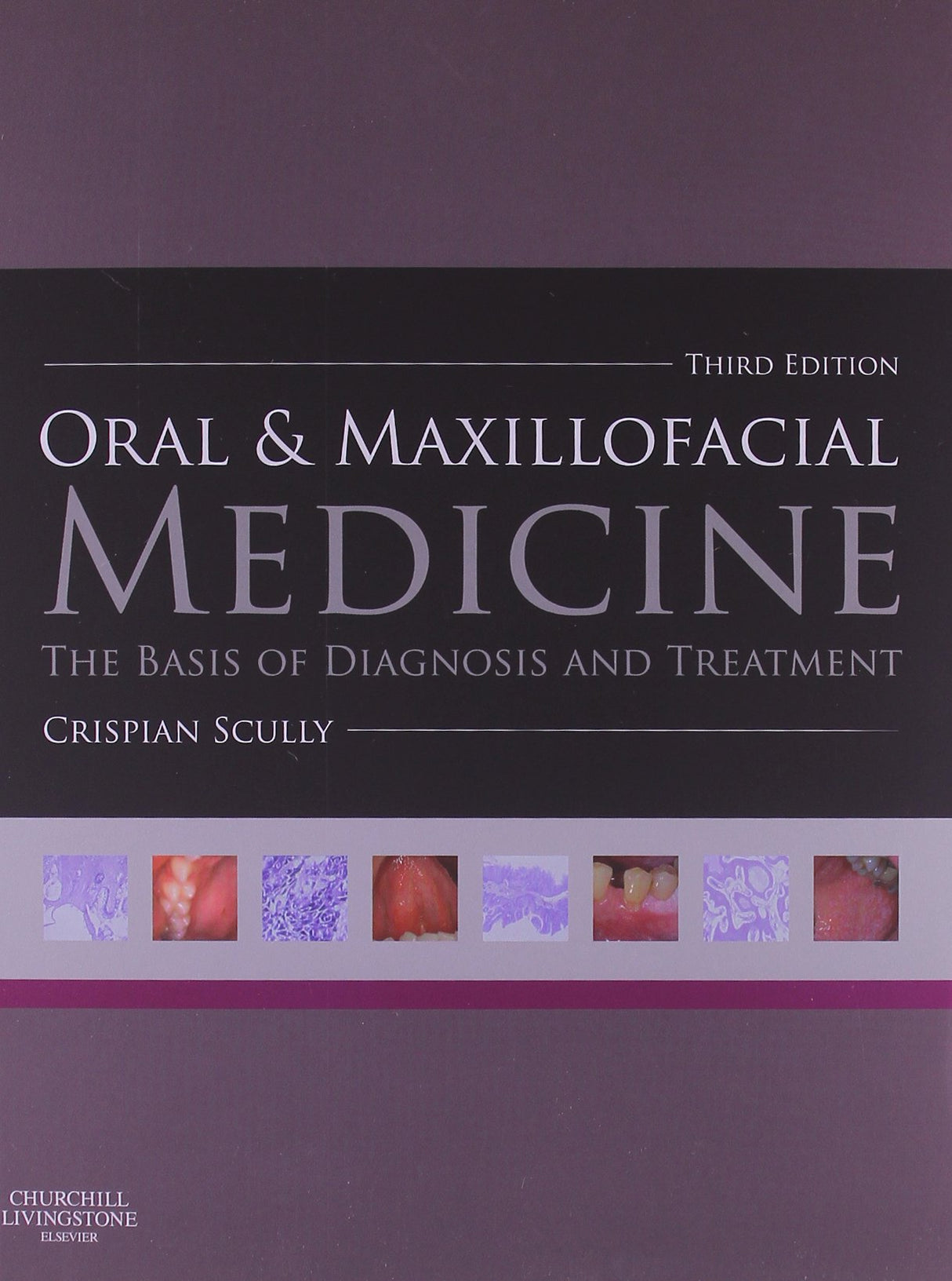 Oral and Maxillofacial Medicine: The Basis of Diagnosis and Treatment