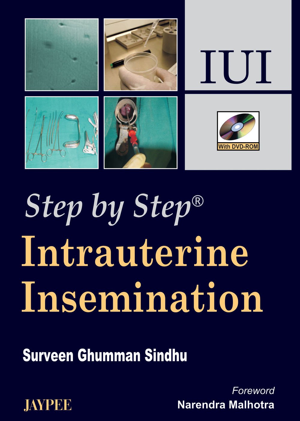 STEP BY STEP INTRAUTERINE INSEMINATION IUI WITH DVD-ROM