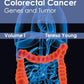 Encyclopedia of Colorectal Cancer: Volume I (Genes and Tumor): 1