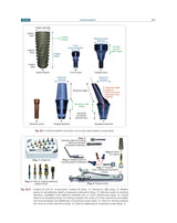 Textbook of Periodontology for Undergraduate Students - 2024