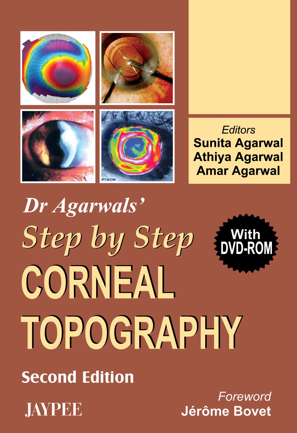 DR.AGARWALS' STEP BY STEP CORNEAL TOPOGRAPHY WITH DVD-ROM