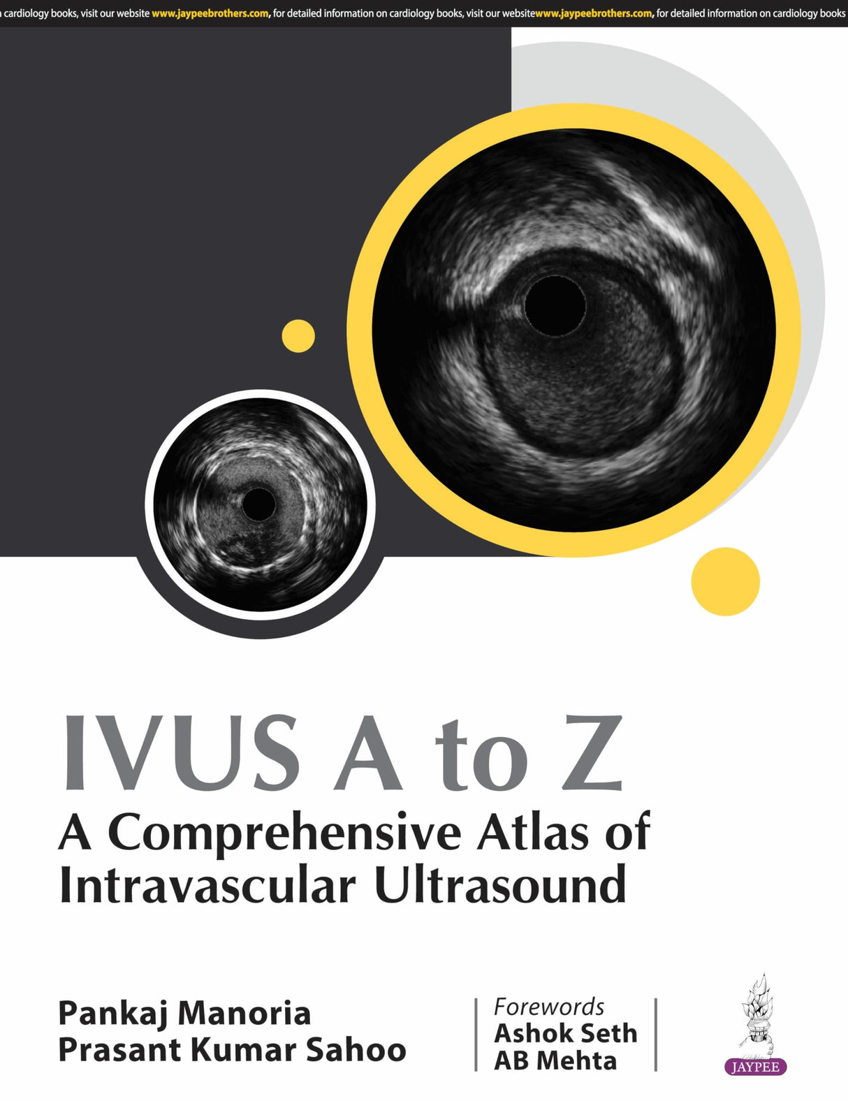 IVUS A TO Z : A COMPREHENSIVE ATLAS OF INTRAVASCULAR ULTRASOUND