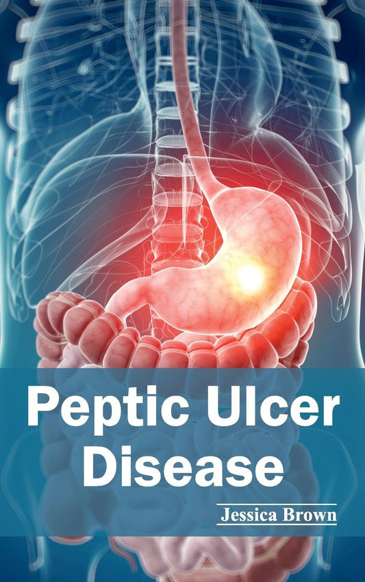 PEPTIC ULCER DISEASE