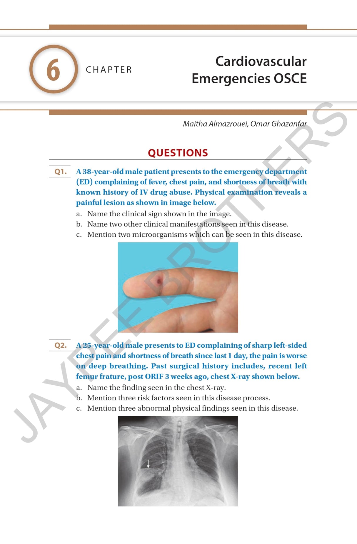 OSCE FOR EMERGENCY MEDICINE PRACTICAL EXAM
