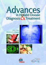 ADVANCES IN HYDATID DISEASE DIAGNOSIS & TREATMENT