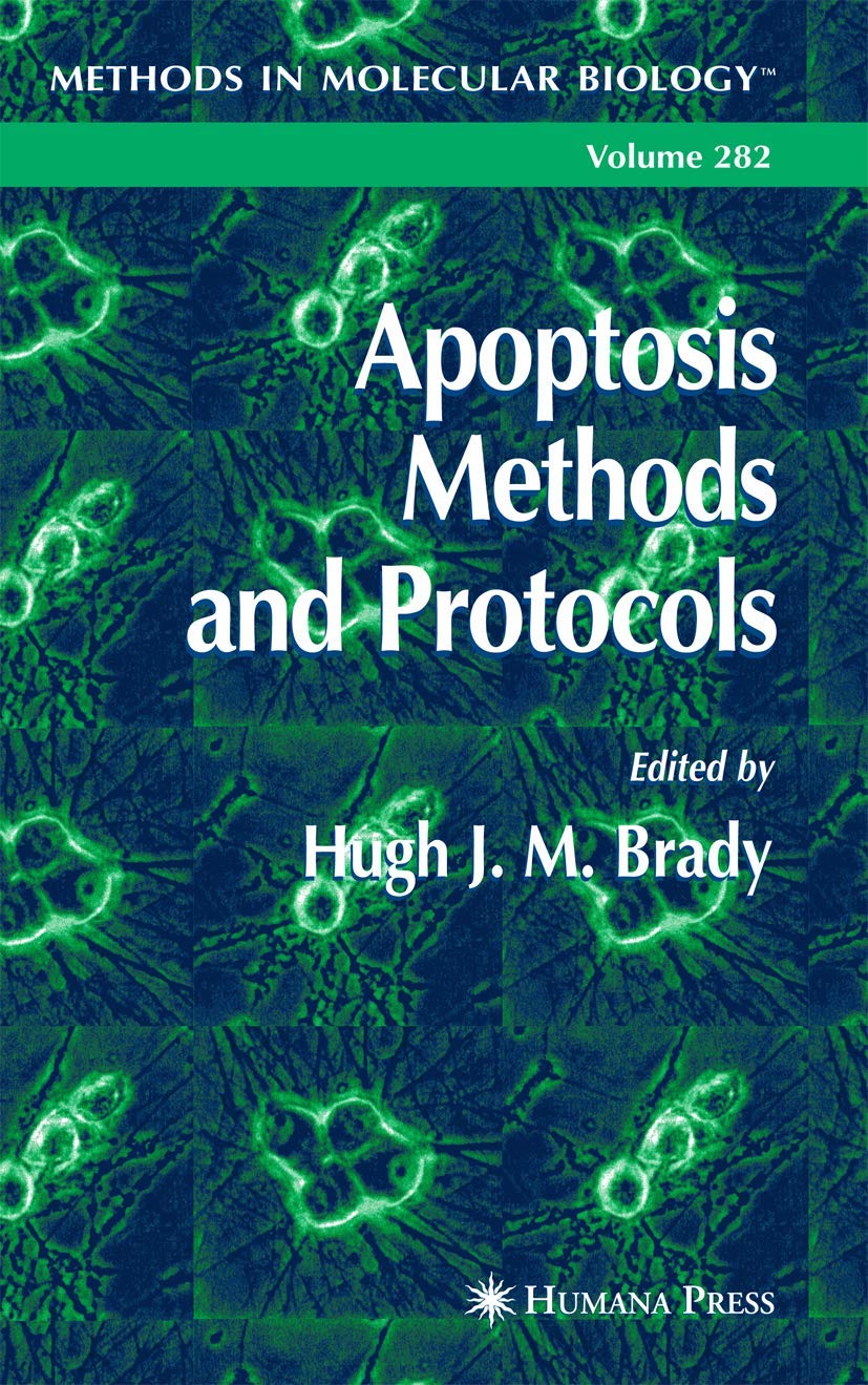 Apoptosis: Methods and Protocols: v. 282 (Methods in Molecular Biology)