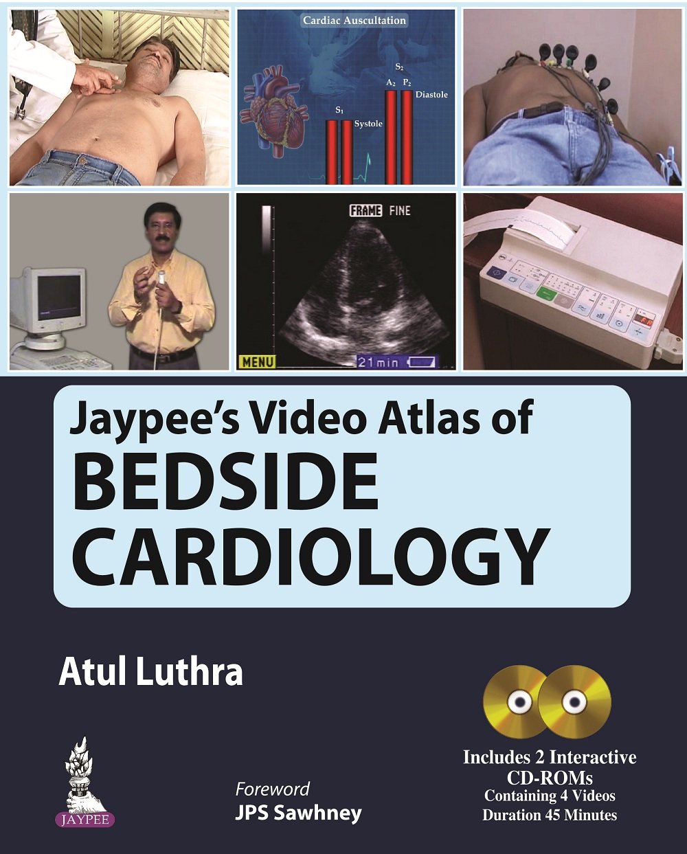 JAYPEE'S VIDEO ATLAS OF BEDSIDE CARDIOLOGY INCLUDES 2 INTERACTIVE CD-ROMS