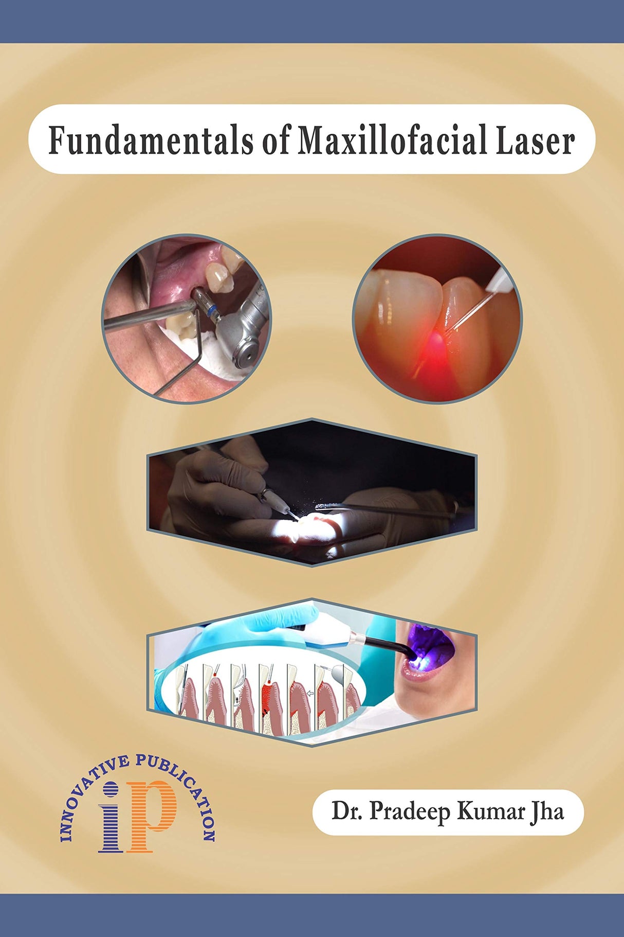 Fundamentals of Maxillofacial Laser