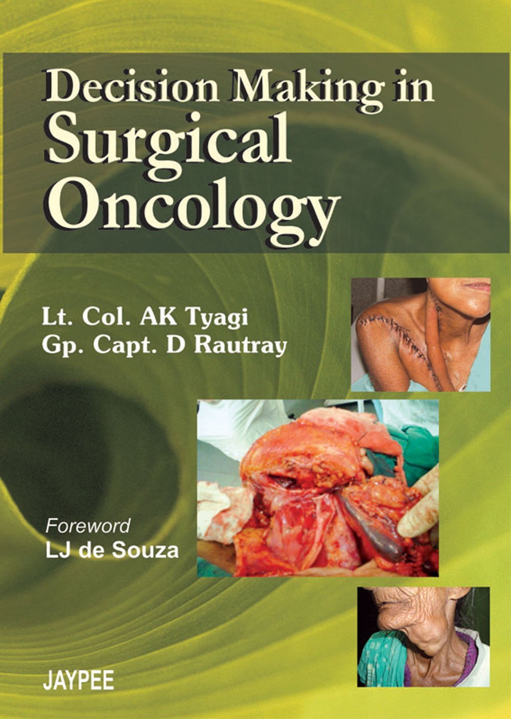 DECISION MAKING IN SURGICAL ONCOLOGY