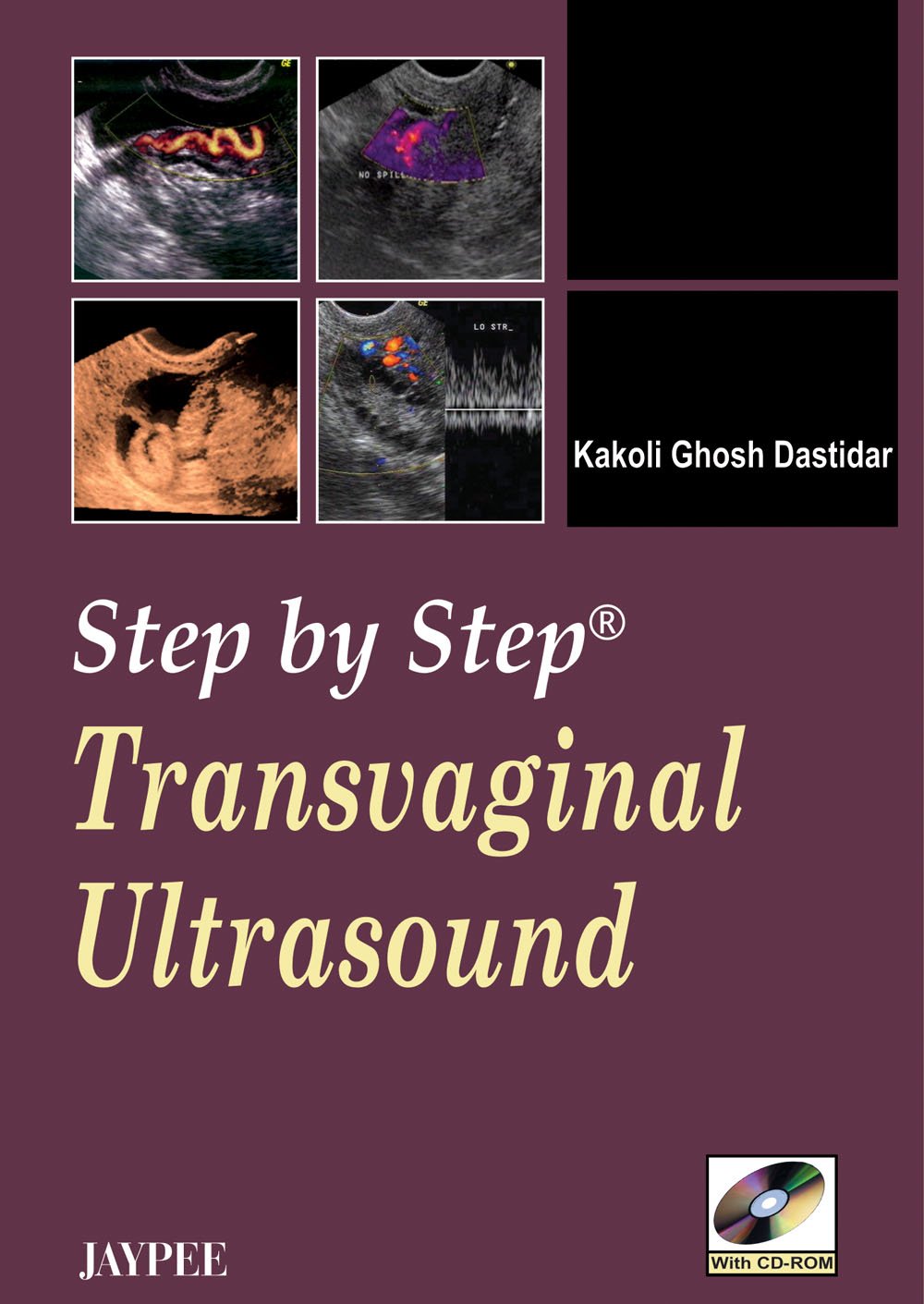 Step by Step Transvaginal Ultrasound with CD-ROM
