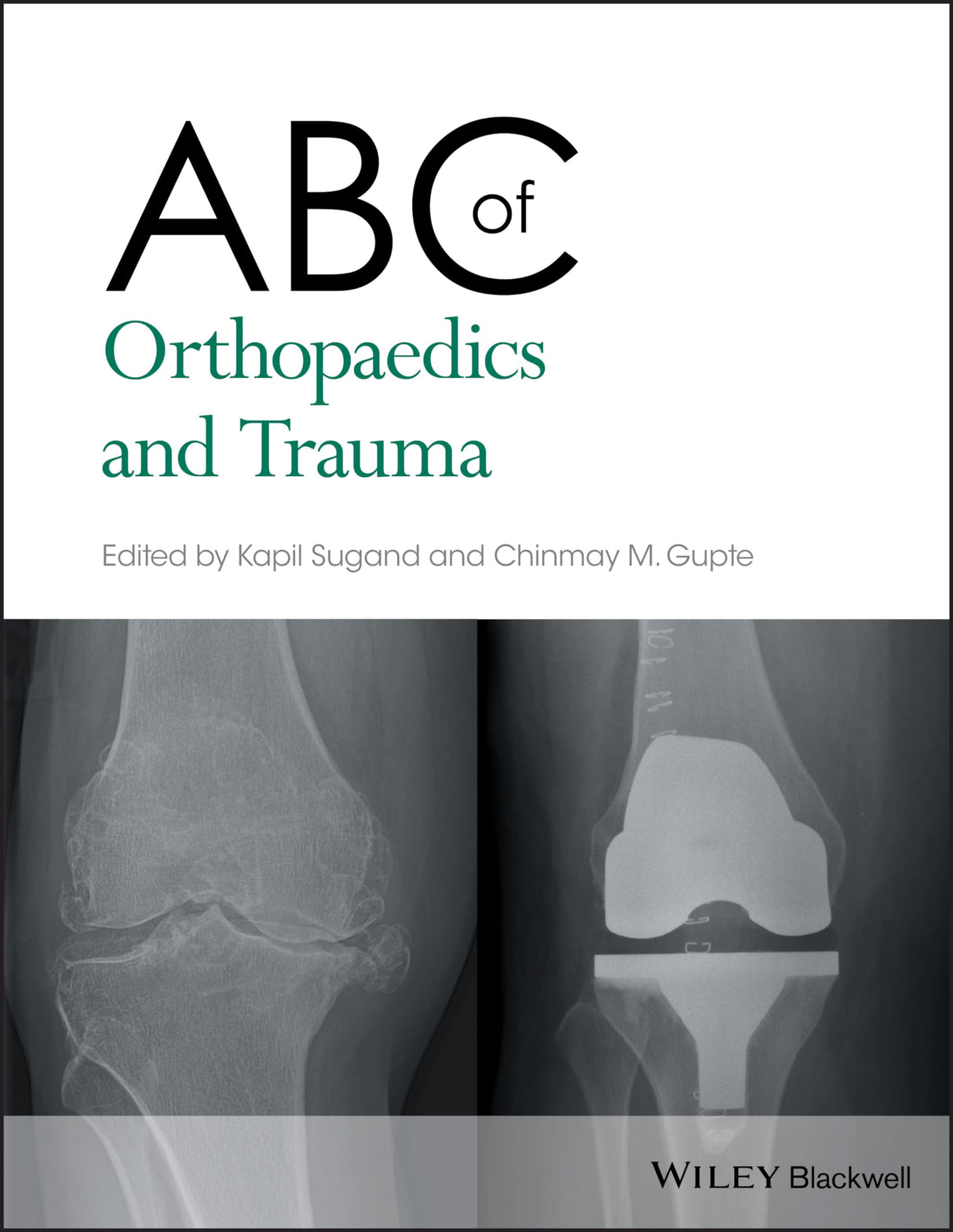 ABC of Orthopaedics and Trauma: 257 (ABC Series)