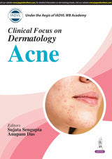 CLINICAL FOCUS ON DERMATOLOGY ACNE