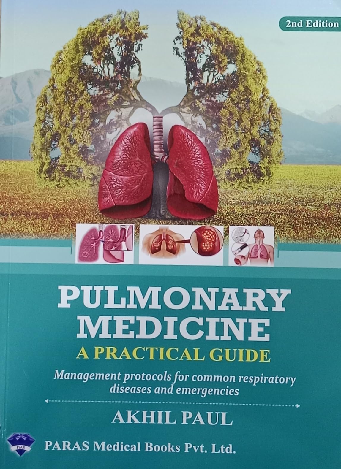 Pulmonary Medicine A practical Guide Management Protocols for common respiratory disease and emergencies [Paperback] Akhil Paul [Paperback] Akhil Paul
