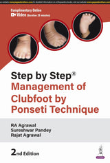 STEP BY STEP MANAGEMENT OF CLUBFOOT BY PONSETI TECHNIQUE