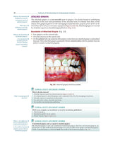 Textbook of Periodontology for Undergraduate Students - 2024