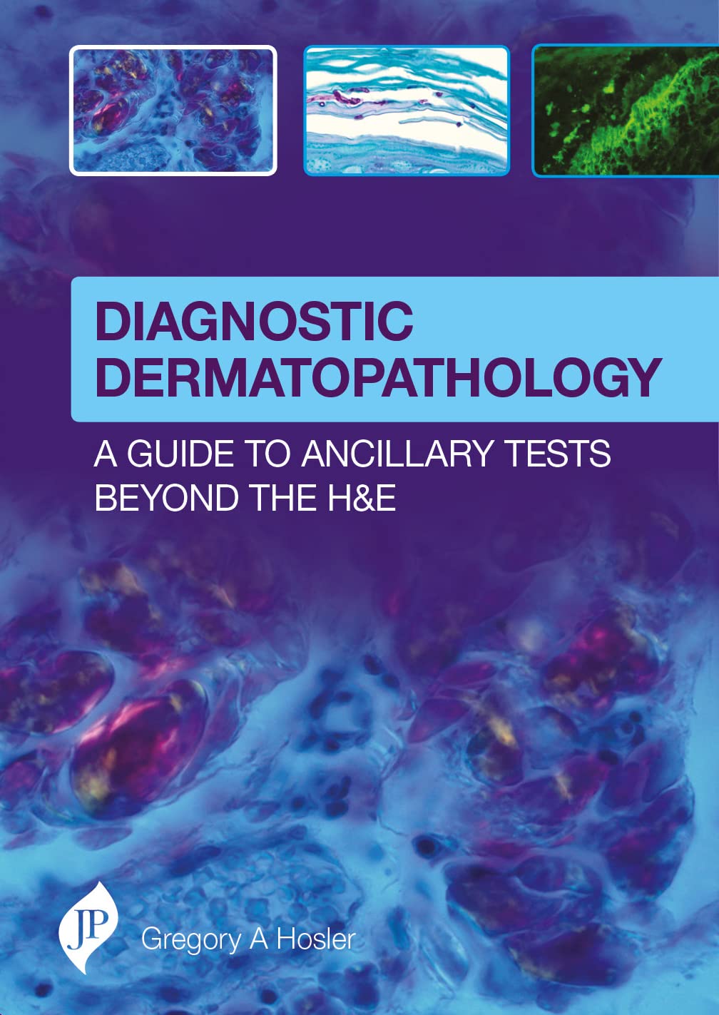DIAGNOSTIC DERMATOPATHOLOGY:A GUIDE TO ANCILLARY TESTS BEYOND THE H&E