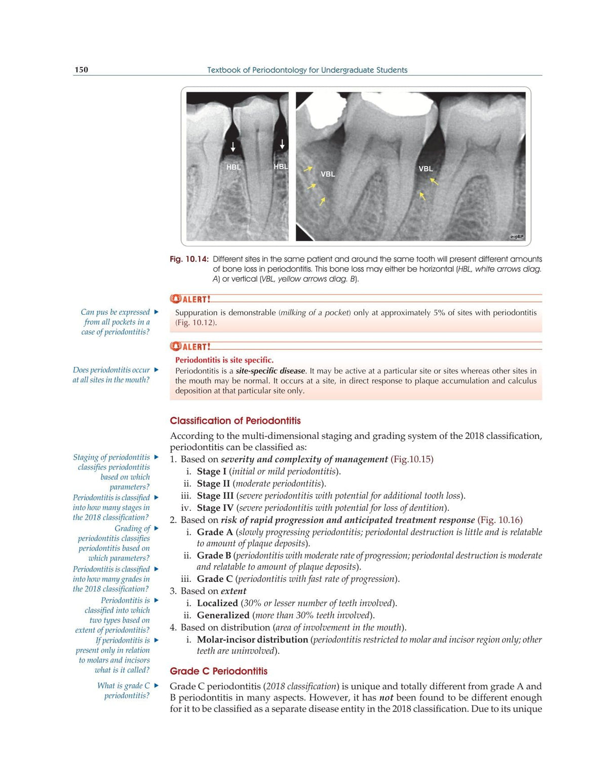 Textbook of Periodontology for Undergraduate Students - 2024