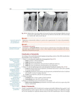 Textbook of Periodontology for Undergraduate Students - 2024