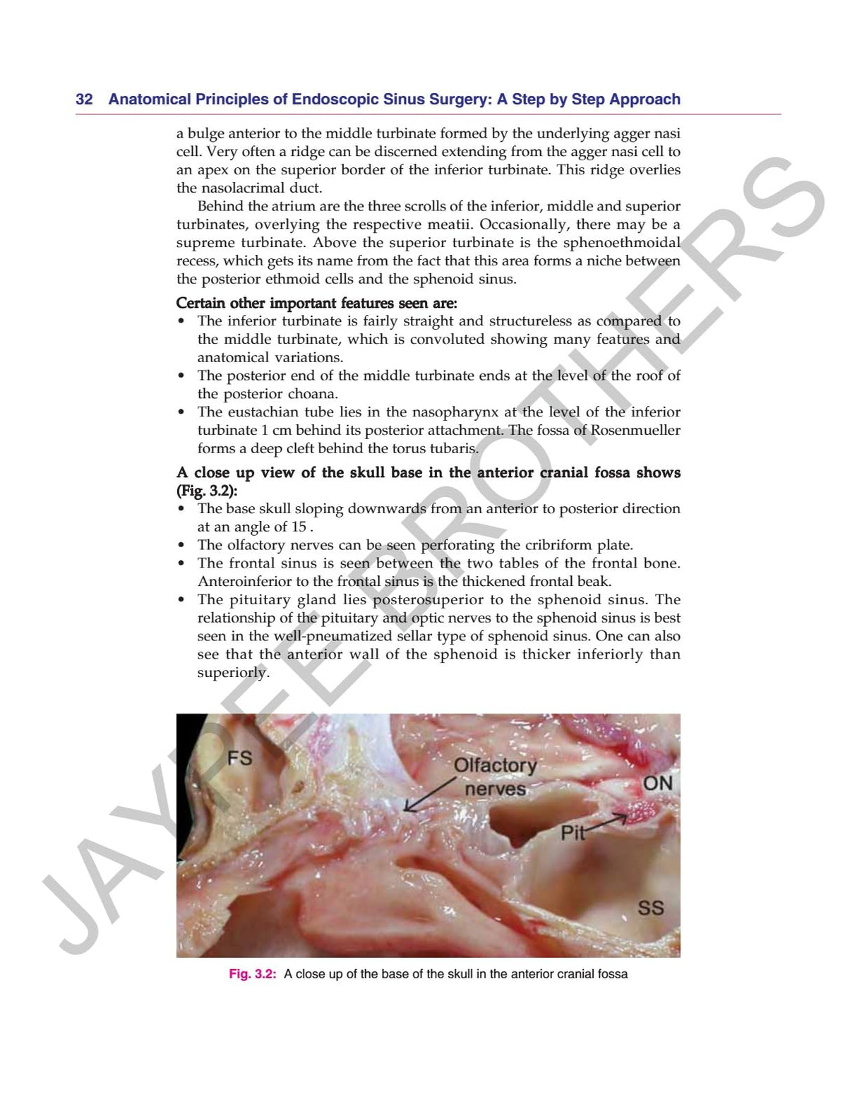 ANATOMICAL PRINCIPLES OF ENDOSCOPIC SINUS SURGERY: A STEP BY STEP APPROACH WITH INTERACTIVE CD-ROM