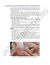 ANATOMICAL PRINCIPLES OF ENDOSCOPIC SINUS SURGERY: A STEP BY STEP APPROACH WITH INTERACTIVE CD-ROM