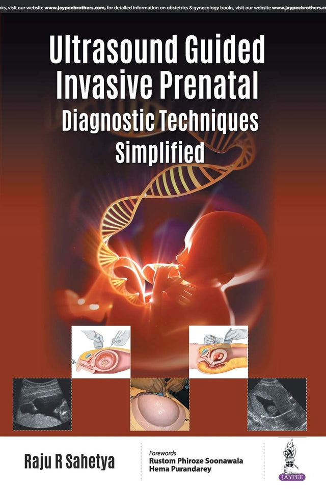 ULTRASOUND GUIDED INVASIVE PRENATAL DIAGNOSTIC TECHNIQUES SIMPLIFIED - Retail Maharaj