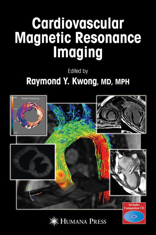 Cardiovascular Magnetic Resonance Imaging (Contemporary Cardiology)