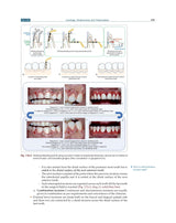 Textbook of Periodontology for Undergraduate Students - 2024