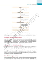 COMPREHENSIVE GUIDE TO URTICARIA