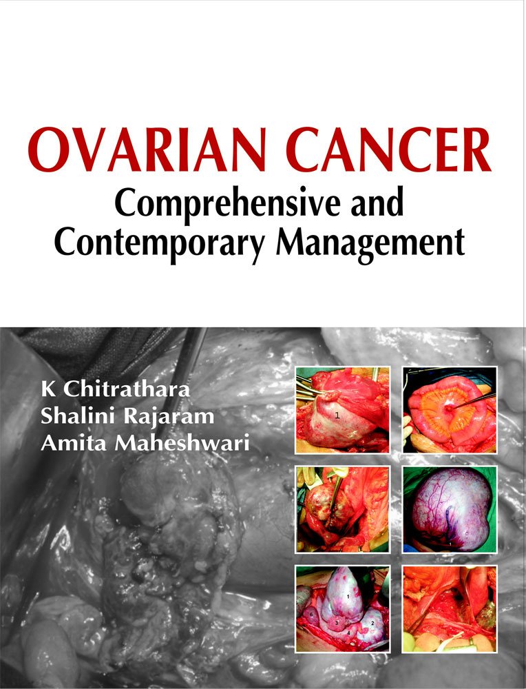 OVARIAN CANCER COMPREHENSIVE AND CONTEMPORARY MANAGEMENT