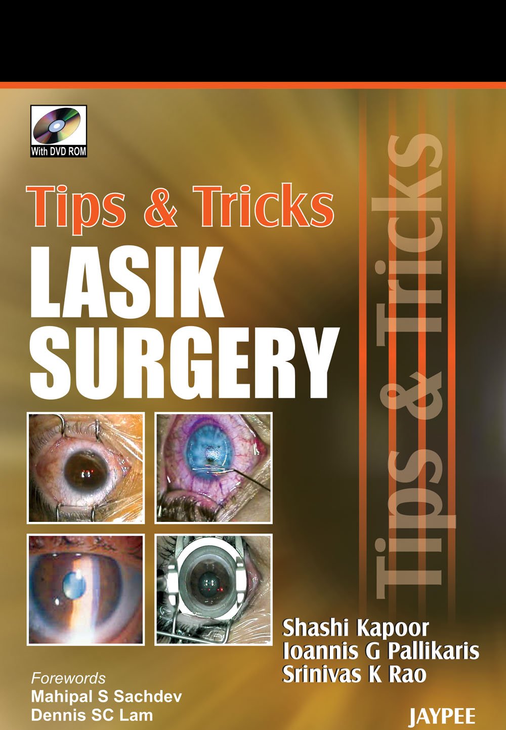 Tips & Tricks Lasik Surgery with DVD-ROM