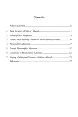 Pleomorphic Adenoma