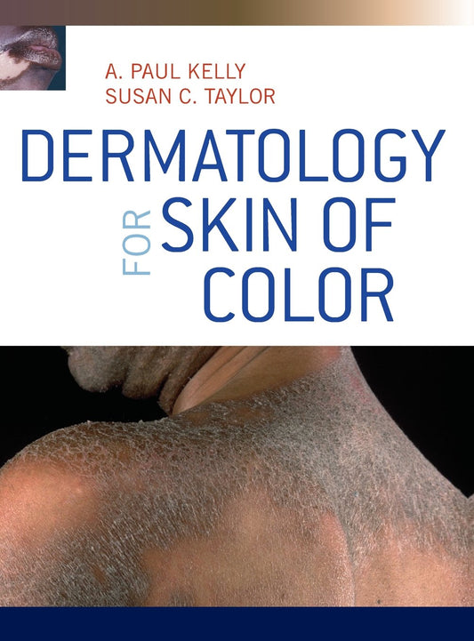 Dermatology for Skin of Color