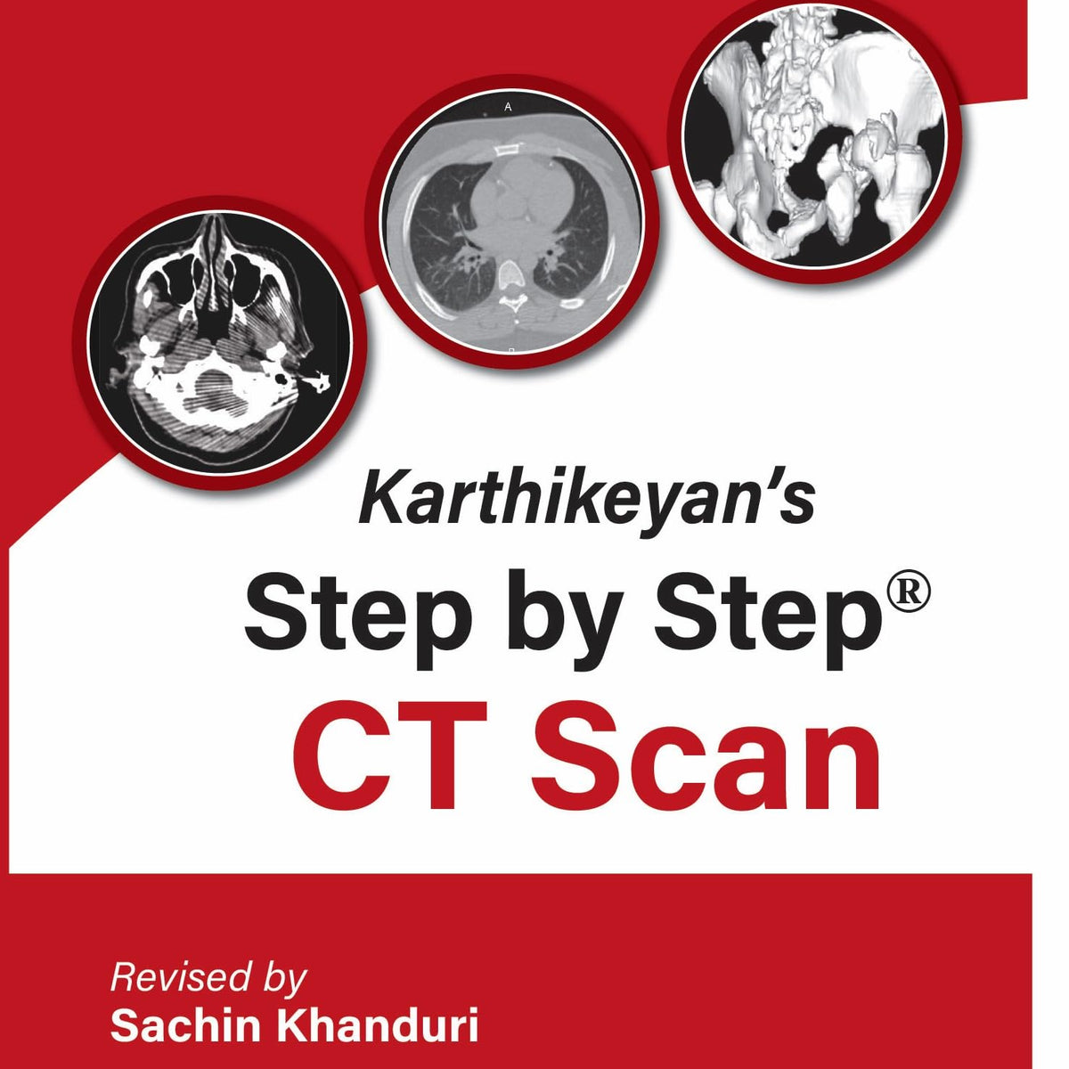 KARTHIKEYAN'S STEP BY STEP CT SCAN
