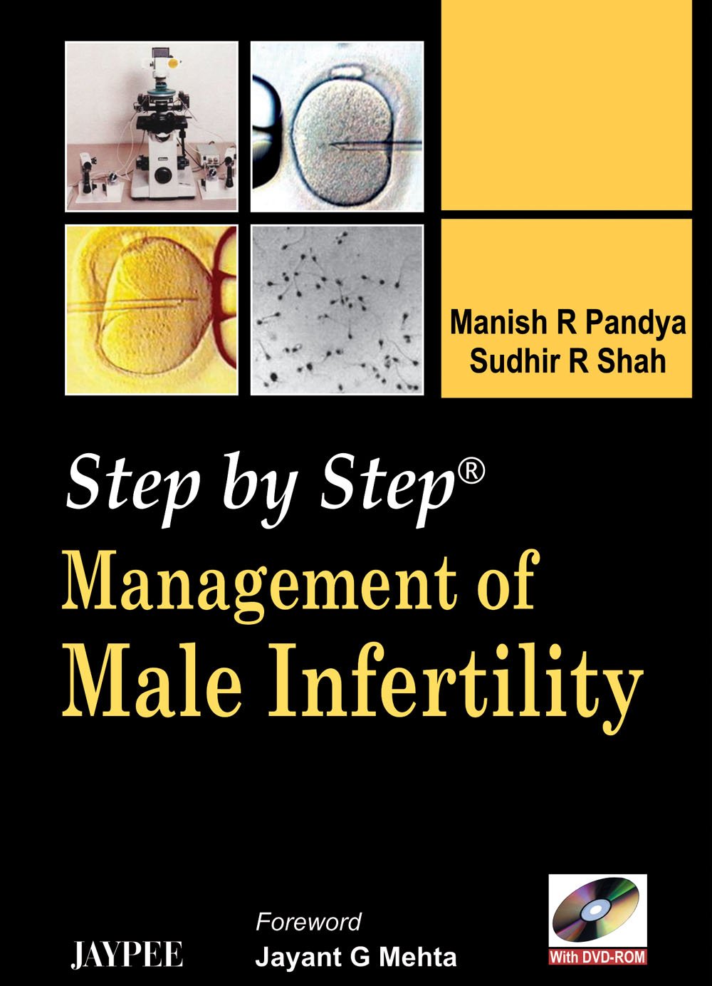 Step by Step Management of Male Infertility with DVD-ROM