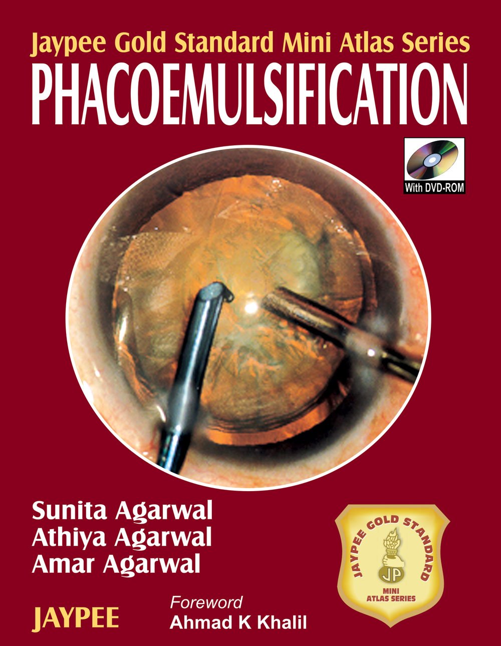 Jaypee Gold Standard Mini Atlas Series Phacoemulsification with DVD-ROM