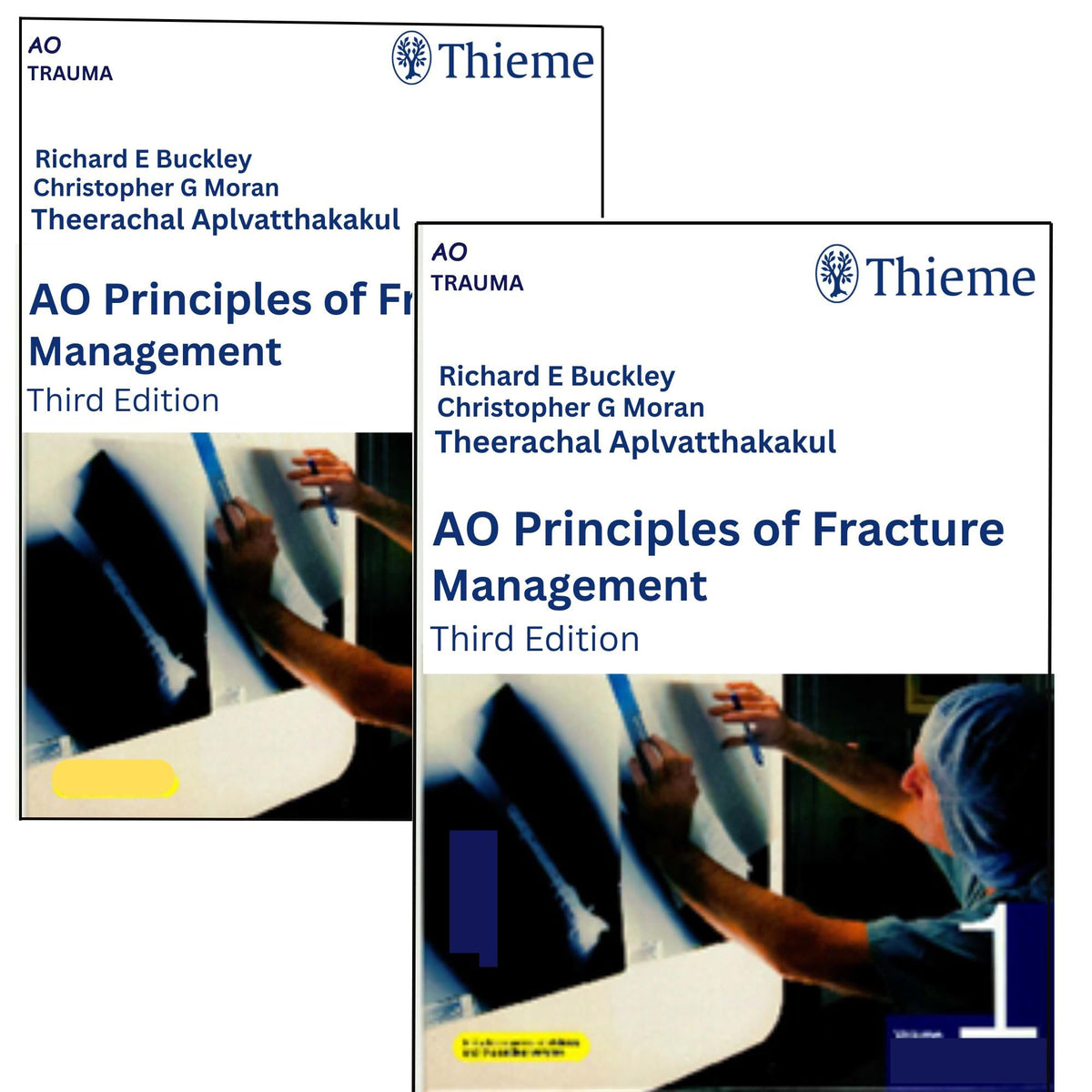 Ao Principles AO Principles of Fracture Management 2 Vol. Set, Vol. 1: Principles, V
