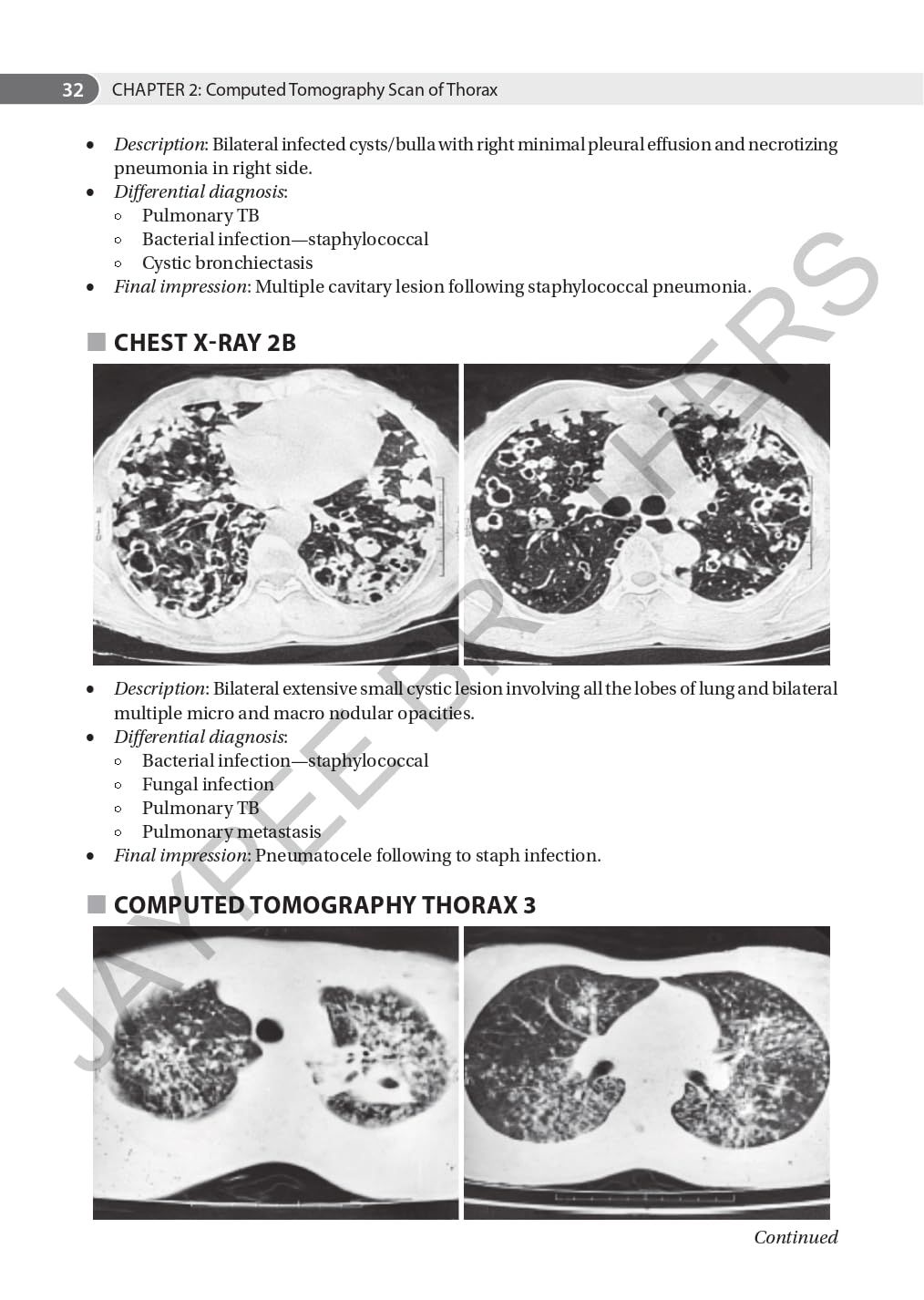 AN AID TO RESPIRATORY MEDICINE FOR POSTGRADUATE EXIT EXAM (MD, DNB AND DIPLOMA)