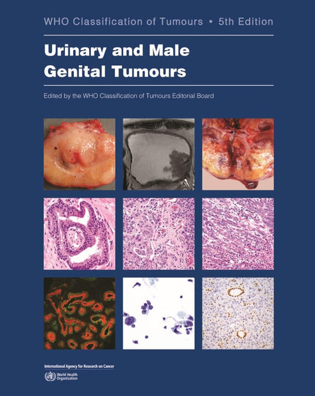 WHO classification of tumours of the urinary system and male genital organs: 8 (World Health Organization classification of tumours, 9) - Retail Maharaj