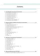 PRACTICAL GUIDE TO INTRAUTERINE INSEMINATION (IUI)