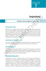 COMPREHENSIVE GUIDE TO URTICARIA