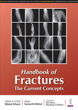 HANDBOOK OF FRACTURES THE CURRENT CONCEPTS - Retail Maharaj