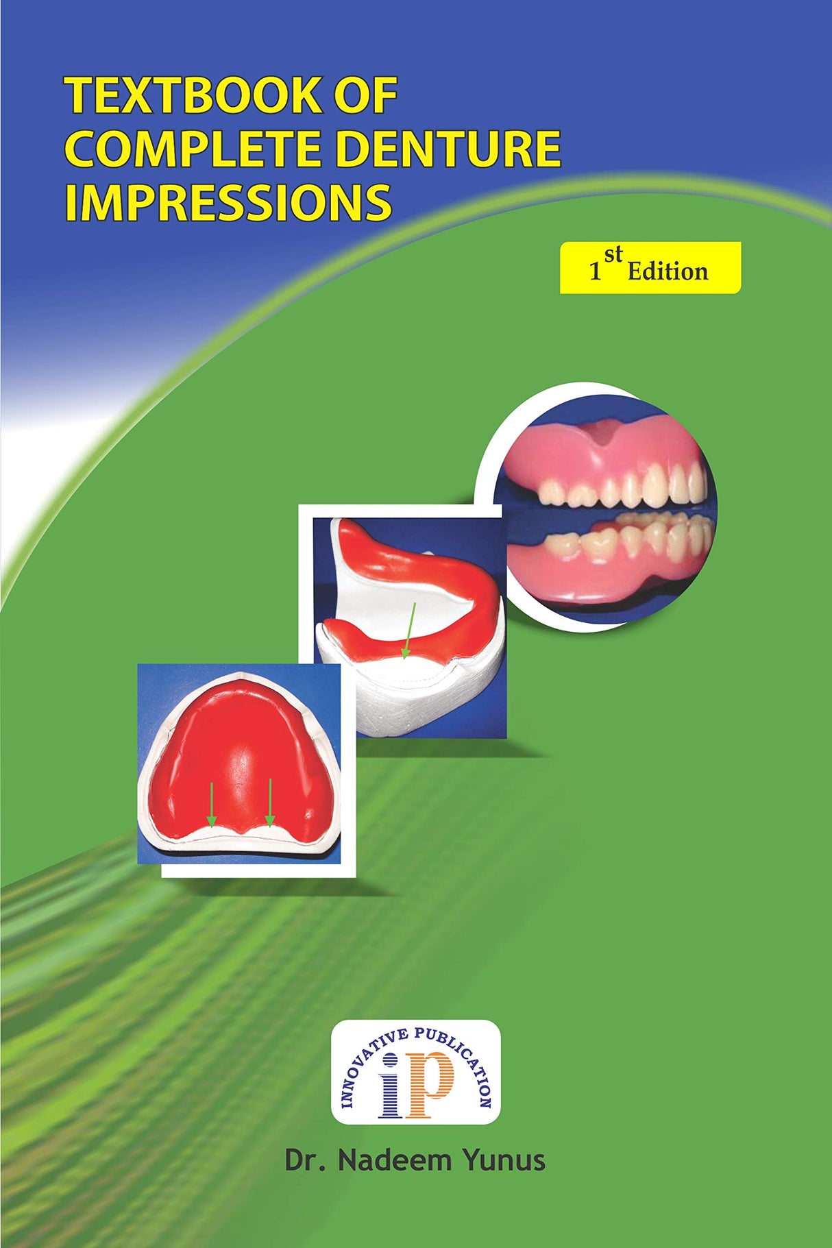 TEXTBOOK OF COMPLETE DENTURE IMPRESSIONS - Complete Knowledge of Impression Making
