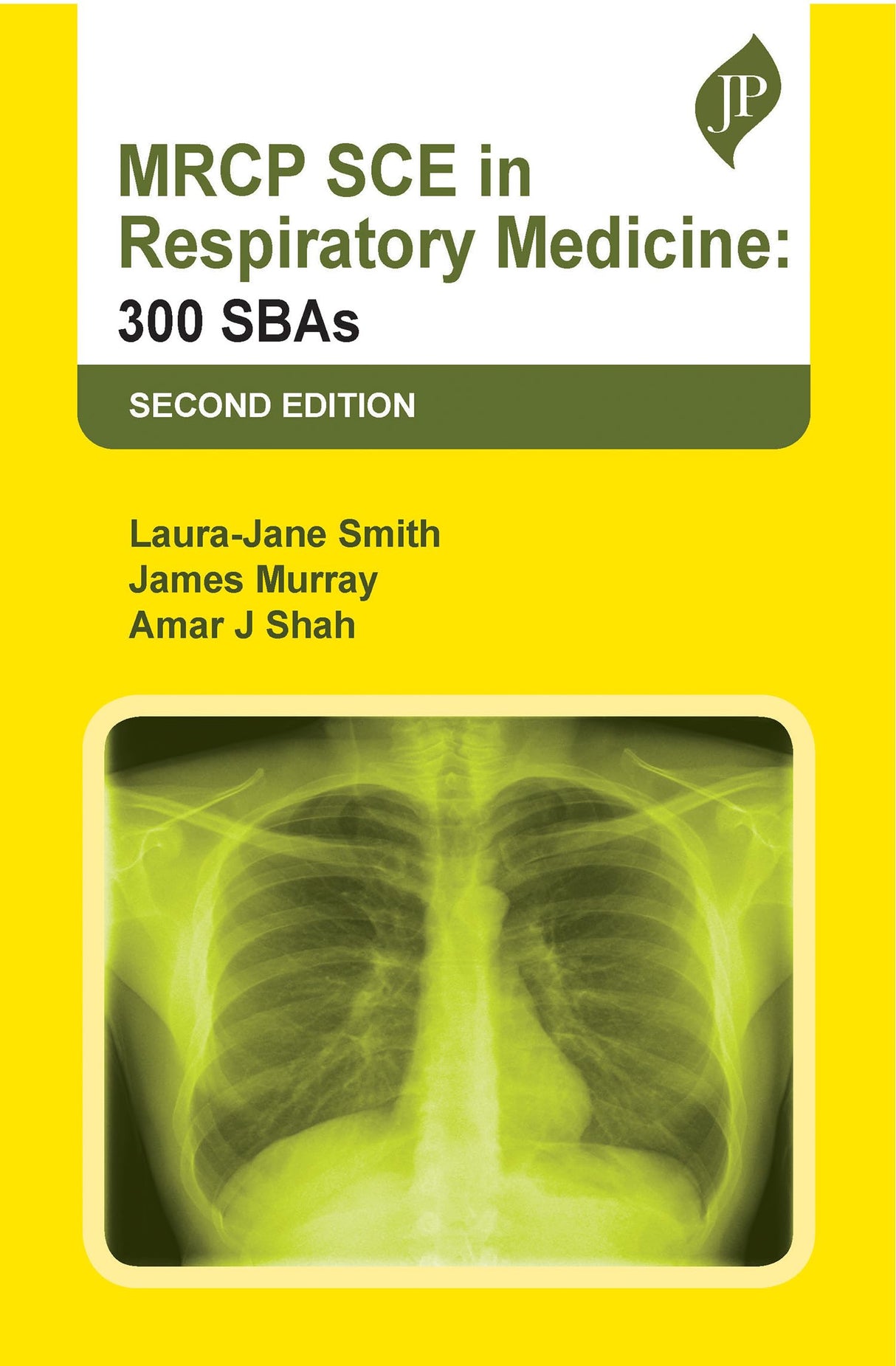 MRCP SCE IN RESPIRATORY MEDICINE: 300 SBAS